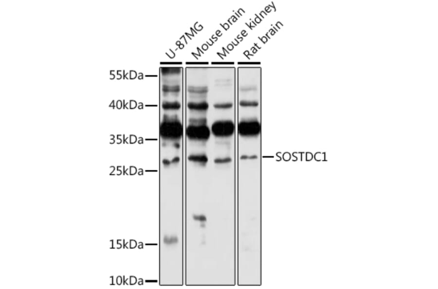 Western Blot - Anti-SOSTDC1 Antibody (A88980) - Antibodies.com