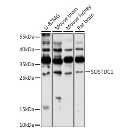 Western Blot - Anti-SOSTDC1 Antibody (A88980) - Antibodies.com