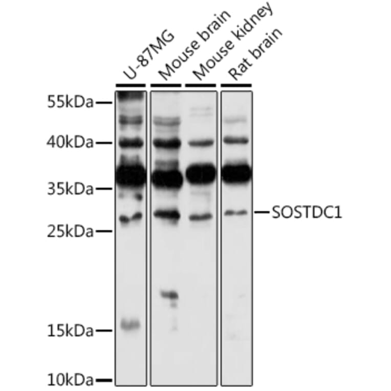 Western Blot - Anti-SOSTDC1 Antibody (A88980) - Antibodies.com