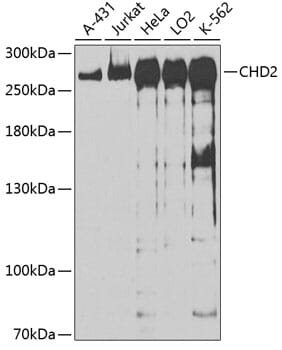 Western blot analysis of extracts of various cell lines, using Anti-CHD2 Antibody (A13478) at 1:1,000 dilution.
Secondary antibody: Goat Anti-Rabbit IgG (H+L) (HRP) (AS014) at 1:10,000 dilution.
Lysates / proteins: 25µg per lane.
Blocking buffer: 3% non-fat dry milk in TBST.
Detection: ECL Basic Kit (RM00020).
Exposure time: 90s.