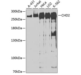 Western Blot - Anti-CHD2 Antibody (A88981) - Antibodies.com