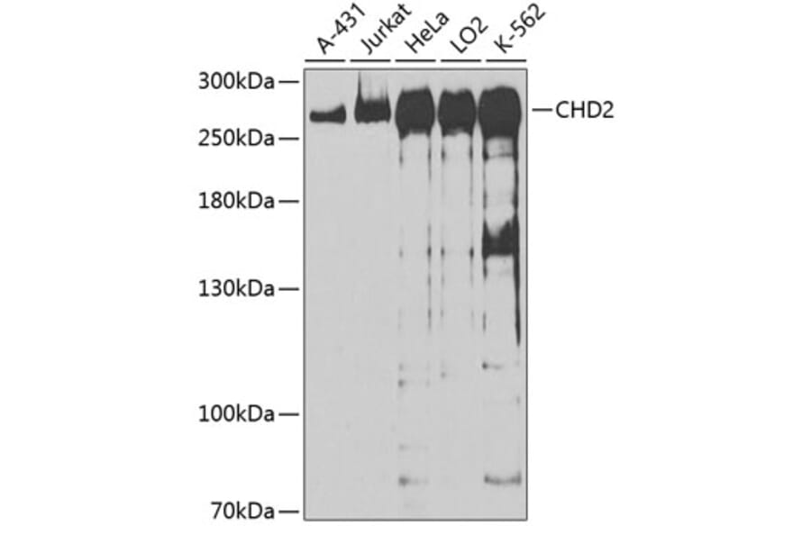Western Blot - Anti-CHD2 Antibody (A88981) - Antibodies.com