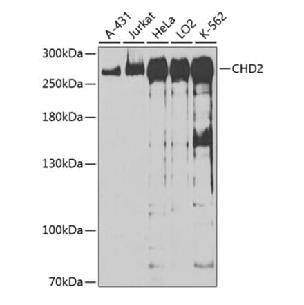 Western Blot - Anti-CHD2 Antibody (A88981) - Antibodies.com