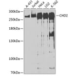 Western Blot - Anti-CHD2 Antibody (A88981) - Antibodies.com