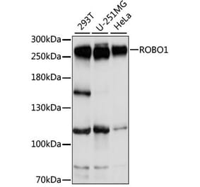 Western Blot - Anti-Robo1 Antibody (A88982) - Antibodies.com