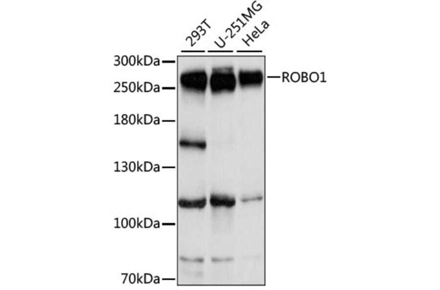 Western Blot - Anti-Robo1 Antibody (A88982) - Antibodies.com