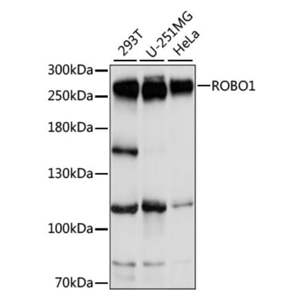 Western Blot - Anti-Robo1 Antibody (A88982) - Antibodies.com