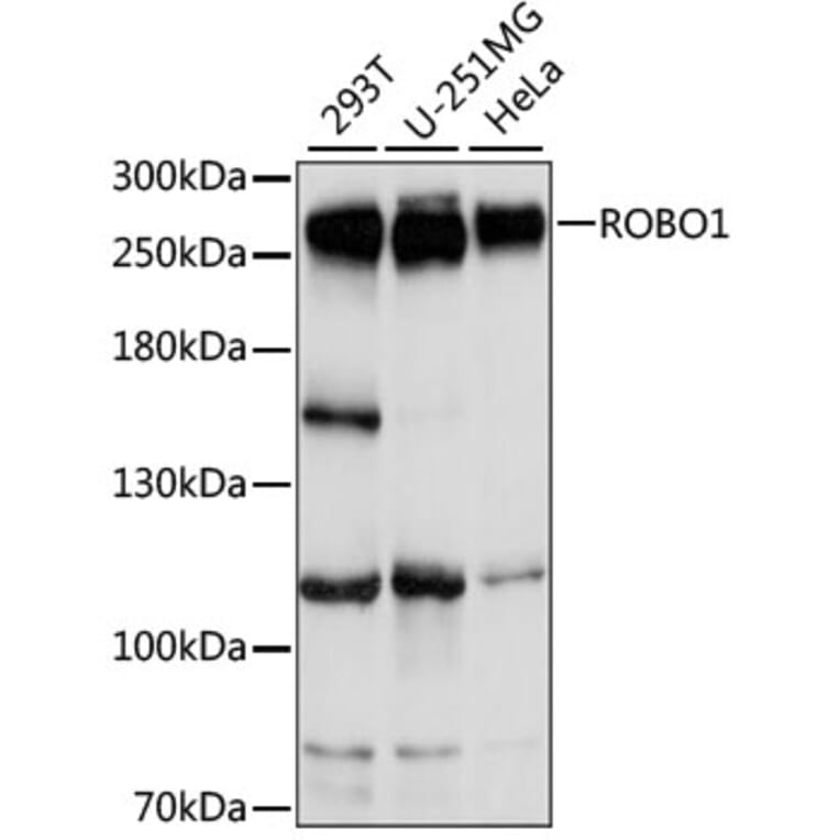 Western Blot - Anti-Robo1 Antibody (A88982) - Antibodies.com