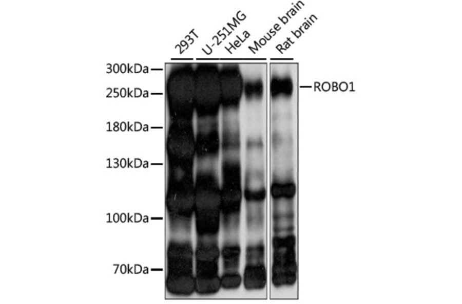 Western Blot - Anti-Robo1 Antibody (A88982) - Antibodies.com