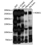 Western Blot - Anti-Robo1 Antibody (A88982) - Antibodies.com