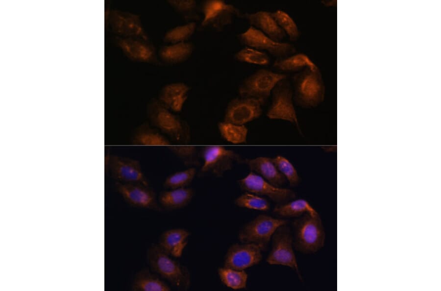 Immunofluorescence - Anti-Robo1 Antibody (A88982) - Antibodies.com