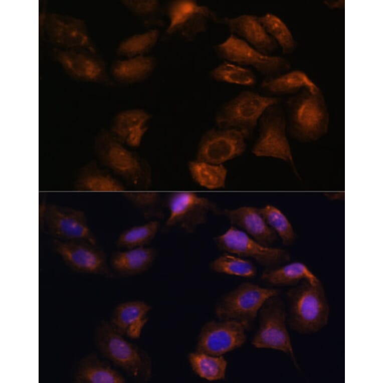 Immunofluorescence - Anti-Robo1 Antibody (A88982) - Antibodies.com
