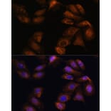 Immunofluorescence - Anti-Robo1 Antibody (A88982) - Antibodies.com