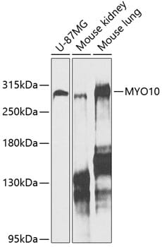 Western blot analysis of extracts of various cell lines, using Anti-MYO10 Antibody (A12471) at 1:1,000 dilution.
Secondary antibody: Goat Anti-Rabbit IgG (H+L) (HRP) (AS014) at 1:10,000 dilution.
Lysates / proteins: 25µg per lane.
Blocking buffer: 3% non-fat dry milk in TBST.
Detection: ECL Enhanced Kit (RM00021).
Exposure time: 20s.