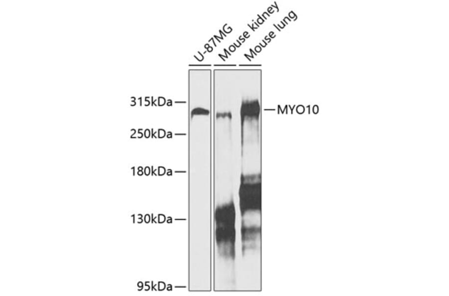 Western Blot - Anti-MYO10 Antibody (A88983) - Antibodies.com