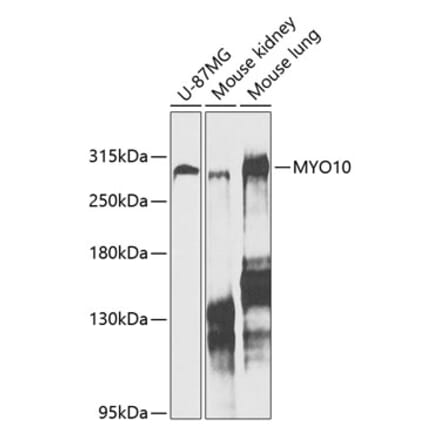 Western Blot - Anti-MYO10 Antibody (A88983) - Antibodies.com