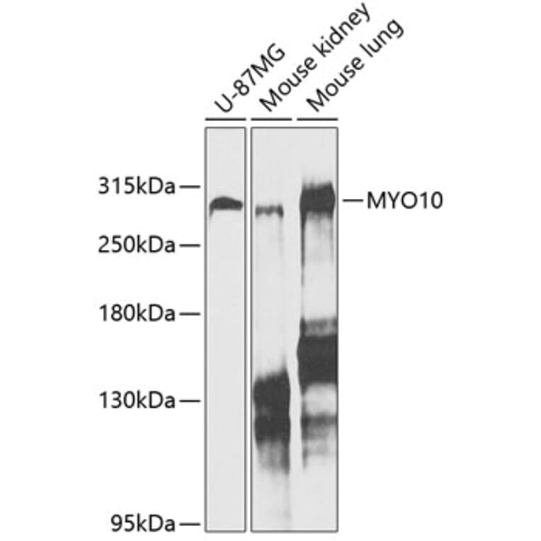 Western Blot - Anti-MYO10 Antibody (A88983) - Antibodies.com