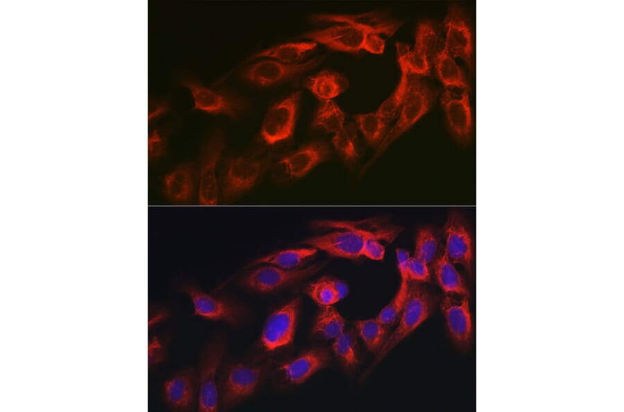 Immunofluorescence - Anti-MYO10 Antibody (A88983) - Antibodies.com