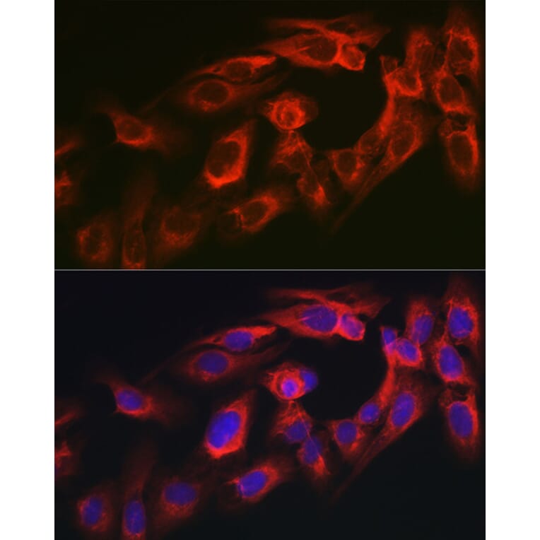 Immunofluorescence - Anti-MYO10 Antibody (A88983) - Antibodies.com