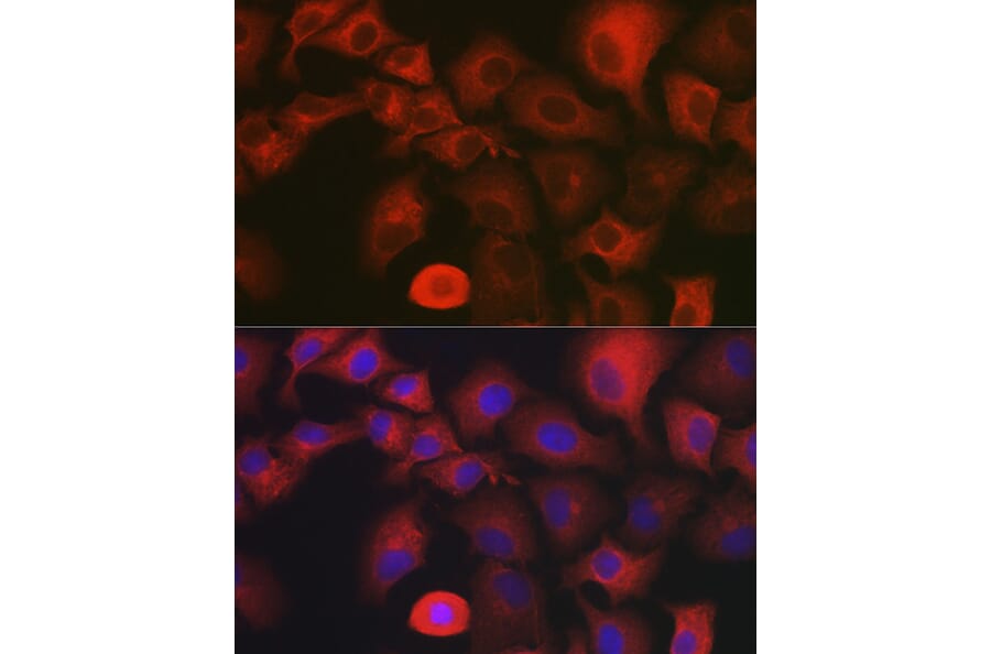 Immunofluorescence - Anti-MYO10 Antibody (A88983) - Antibodies.com