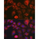 Immunofluorescence - Anti-MYO10 Antibody (A88983) - Antibodies.com