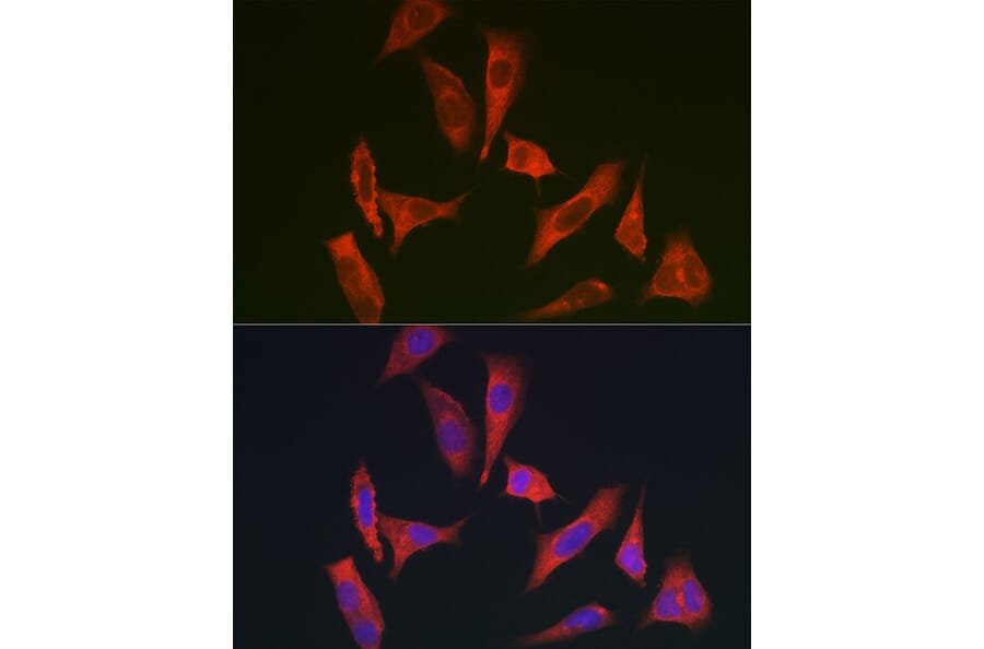 Immunofluorescence - Anti-MYO10 Antibody (A88983) - Antibodies.com
