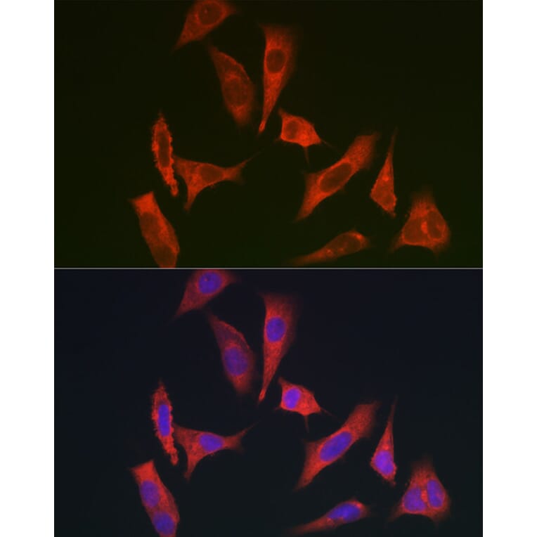 Immunofluorescence - Anti-MYO10 Antibody (A88983) - Antibodies.com