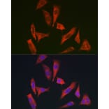 Immunofluorescence - Anti-MYO10 Antibody (A88983) - Antibodies.com