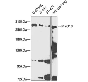 Western Blot - Anti-MYO10 Antibody (A88984) - Antibodies.com