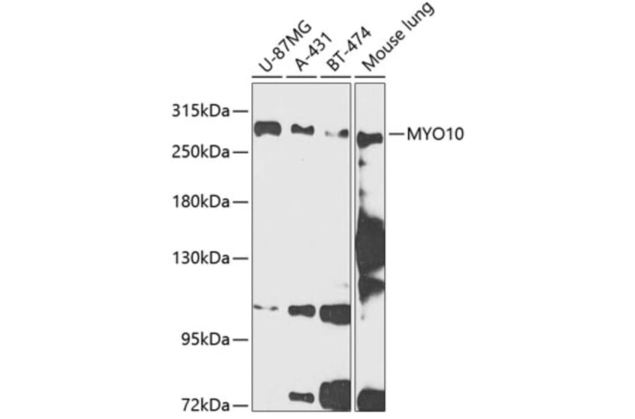 Western Blot - Anti-MYO10 Antibody (A88984) - Antibodies.com