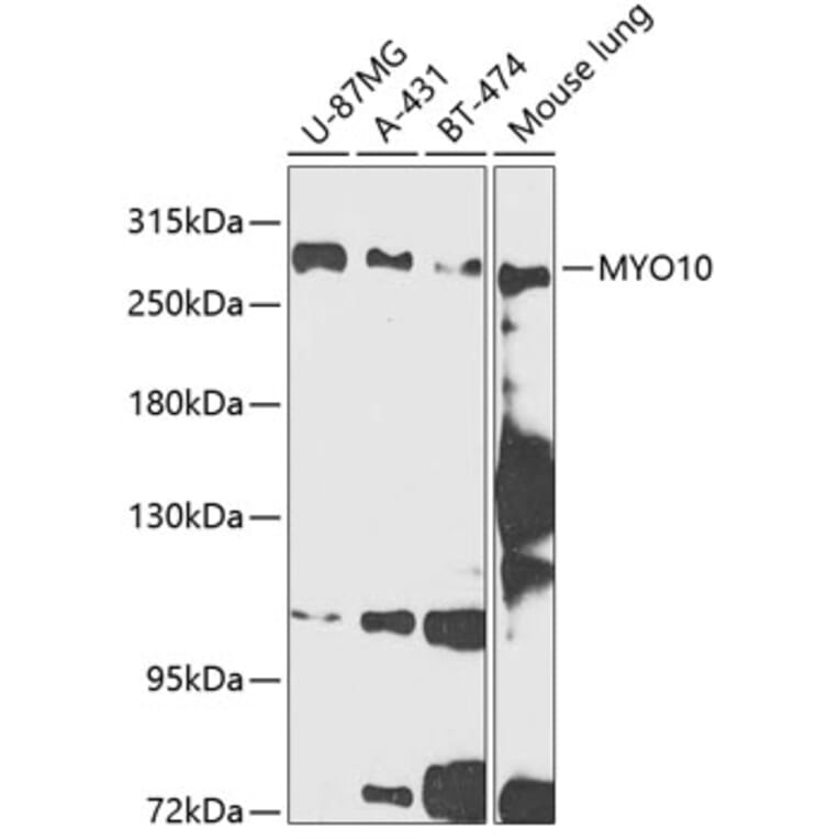 Western Blot - Anti-MYO10 Antibody (A88984) - Antibodies.com