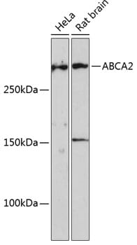 Western blot analysis of extracts of mouse brain, using Anti-ABCA2 Antibody (A16735) at 1:1,000 dilution.
Secondary antibody: Goat Anti-Rabbit IgG (H+L) (HRP) (AS014) at 1:10,000 dilution.
Lysates / proteins: 25µg per lane.
Blocking buffer: 3% non-fat dry milk in TBST.
Detection: ECL Basic Kit (RM00020).
Exposure time: 3min.