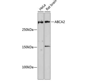 Western Blot - Anti-ABCA2 Antibody (A88985) - Antibodies.com