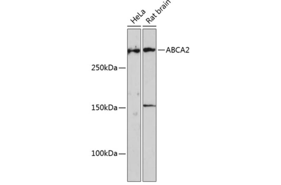 Western Blot - Anti-ABCA2 Antibody (A88985) - Antibodies.com