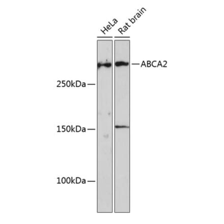 Western Blot - Anti-ABCA2 Antibody (A88985) - Antibodies.com