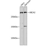 Western Blot - Anti-ABCA2 Antibody (A88985) - Antibodies.com