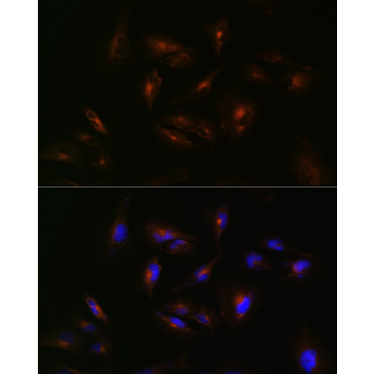 Immunofluorescence - Anti-ABCA2 Antibody (A88985) - Antibodies.com