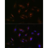 Immunofluorescence - Anti-ABCA2 Antibody (A88985) - Antibodies.com