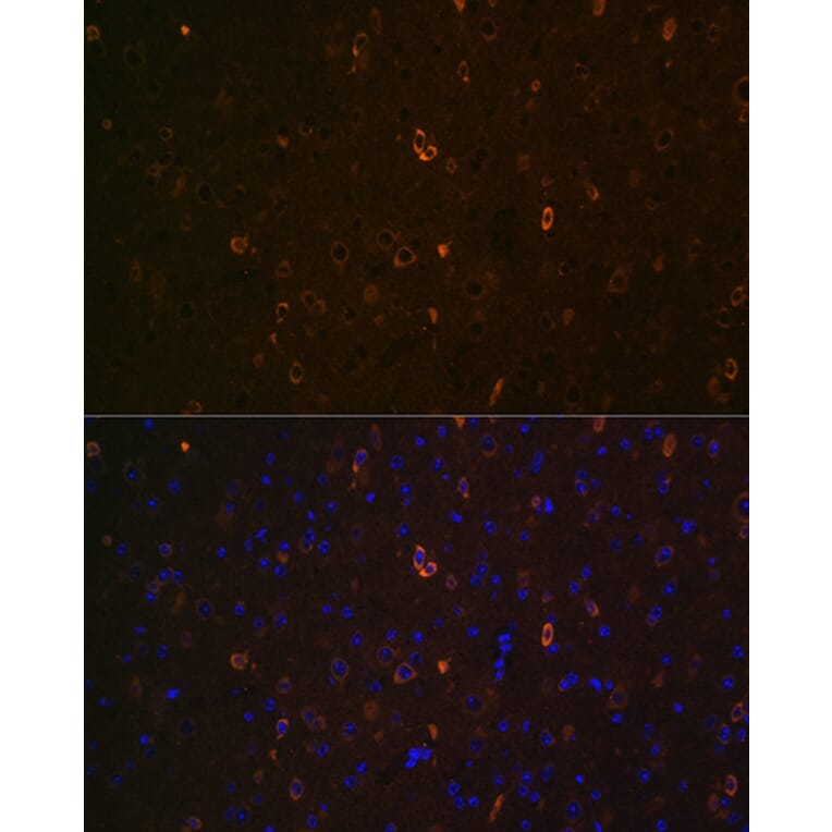 Immunofluorescence - Anti-ABCA2 Antibody (A88985) - Antibodies.com