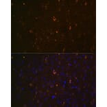 Immunofluorescence - Anti-ABCA2 Antibody (A88985) - Antibodies.com