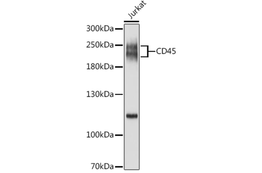 Western Blot - Anti-CD45 Antibody (A88986) - Antibodies.com