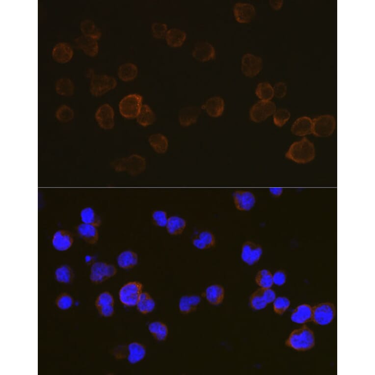 Immunofluorescence - Anti-CD45 Antibody (A88986) - Antibodies.com