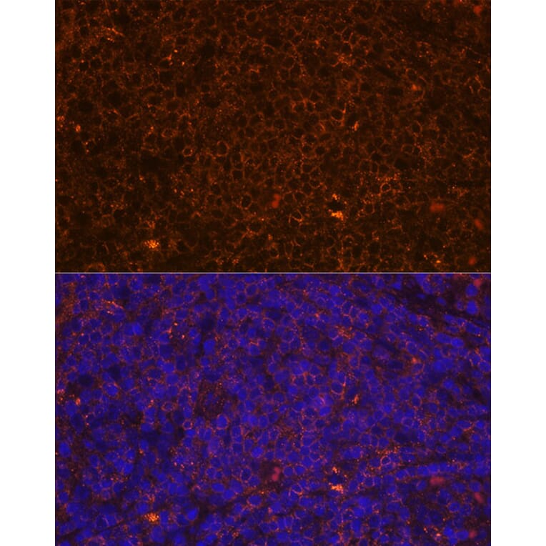 Immunofluorescence - Anti-CD45 Antibody (A88986) - Antibodies.com