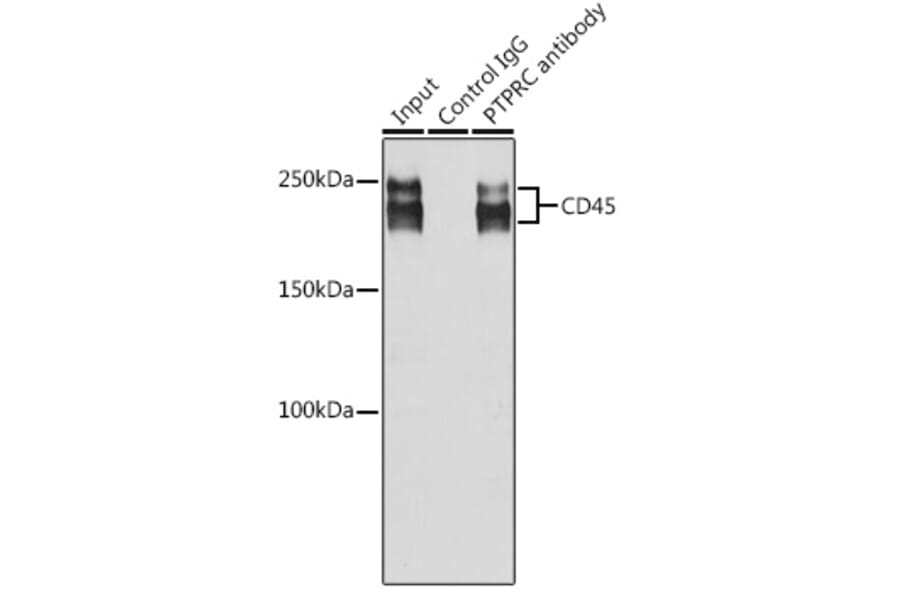 Western Blot - Anti-CD45 Antibody (A88986) - Antibodies.com