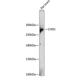 Western Blot - Anti-CHD2 Antibody (A88987) - Antibodies.com