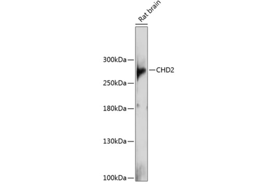 Western Blot - Anti-CHD2 Antibody (A88987) - Antibodies.com