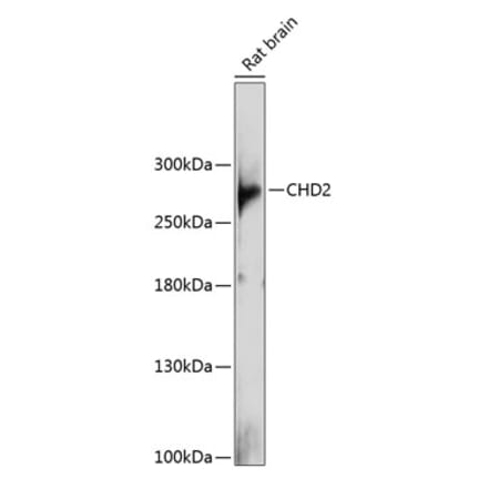 Western Blot - Anti-CHD2 Antibody (A88987) - Antibodies.com