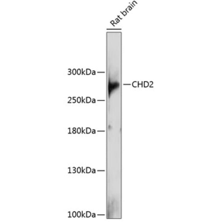 Western Blot - Anti-CHD2 Antibody (A88987) - Antibodies.com