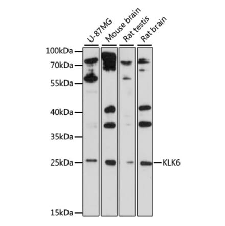 Western Blot - Anti-Kallikrein 6 Antibody (A88988) - Antibodies.com