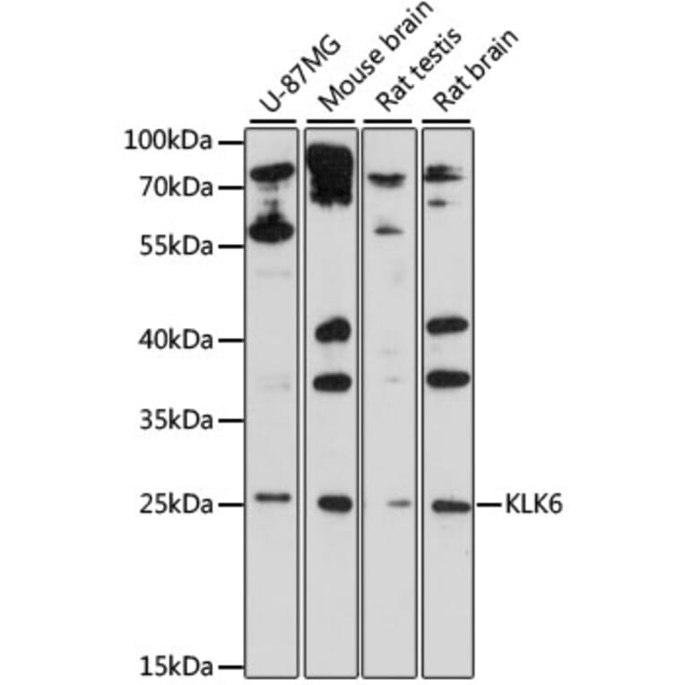 Western Blot - Anti-Kallikrein 6 Antibody (A88988) - Antibodies.com